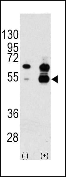 Polyclonal Rabbit anti-Human VEGFA / VEGF Antibody (aa66-95, IHC, WB)