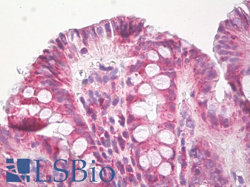 Polyclonal Rabbit anti-Human EPHB3 / EPH Receptor B3 Antibody (aa552-601, IHC, WB)