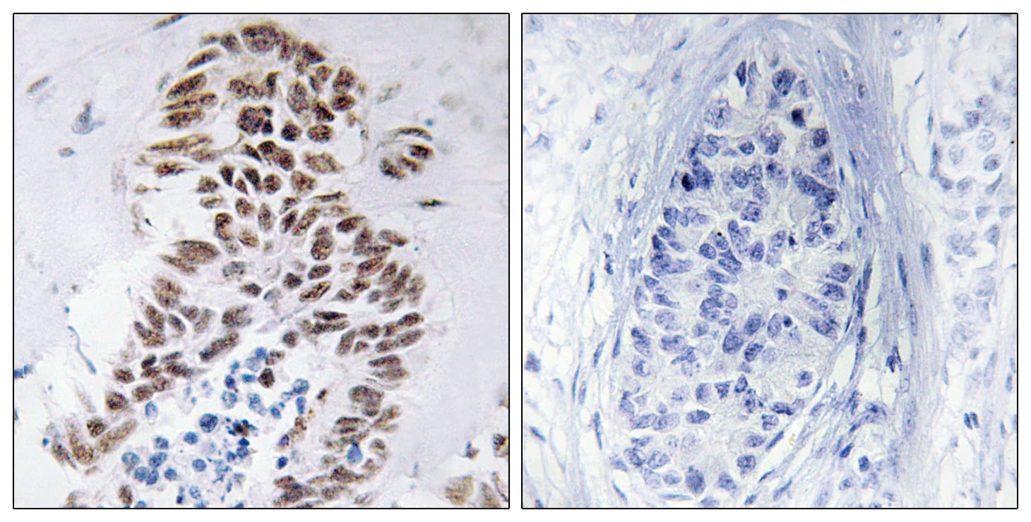 DAPK3 / ZIP Kinase Antibody (aa241-290)