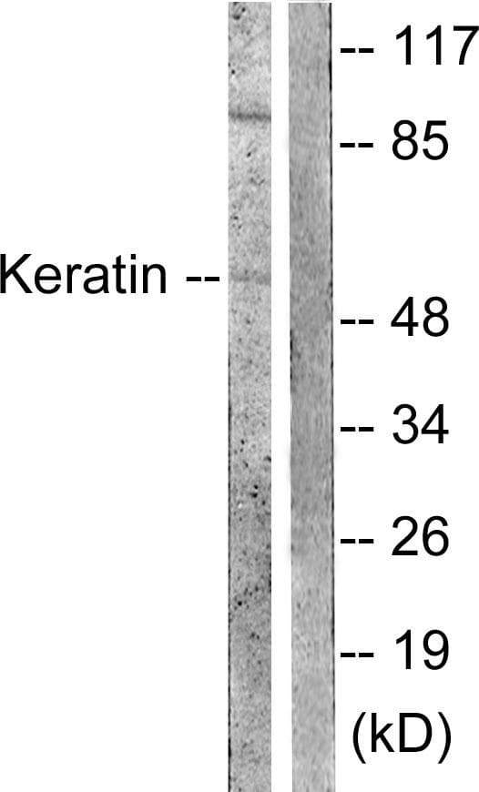 Polyclonal Rabbit anti-Human KRT8 / CK8 / Cytokeratin 8 Antibody (p73, IHC, IF, WB)