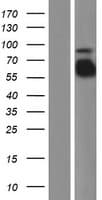 FGA / Fibrinogen Alpha Protein (Over-Expression Lysate Myc-DDK (Flag))