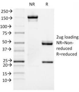 FOXA1 Antibody (clone FOXA1/1519)