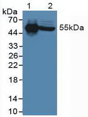 IL6R / IL6 Receptor Antibody (aa216-356, APC)