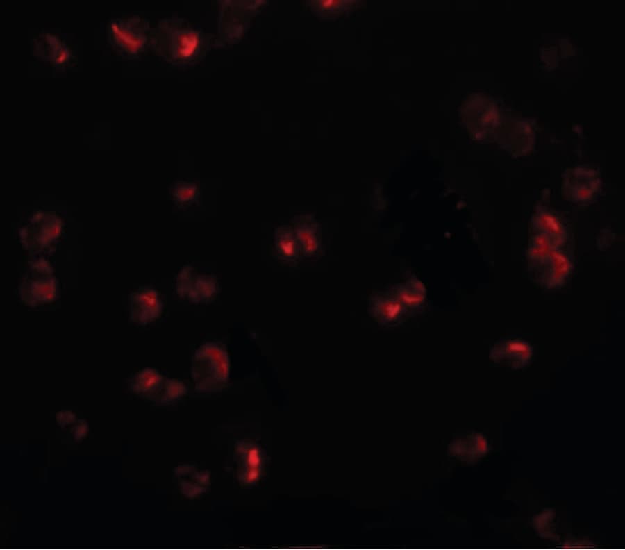 IHC-plus™ Polyclonal Rabbit anti-Human CHORDC1 / CHP1 Antibody (IHC, IF, WB)