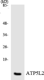 Polyclonal Rabbit anti-Human ATP5L2 Antibody (aa50-99, WB)