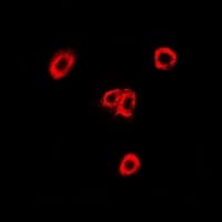 OXA1L / OXA1 Antibody