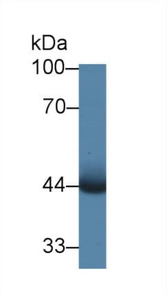 PIM1 / Pim-1 Antibody (aa122-261)