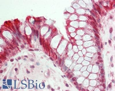 IHC-plus™ UBR5 Antibody (aa14-63)
