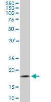 IHC-plus™ TOMM22 / TOM22 Antibody (clone 4G4)