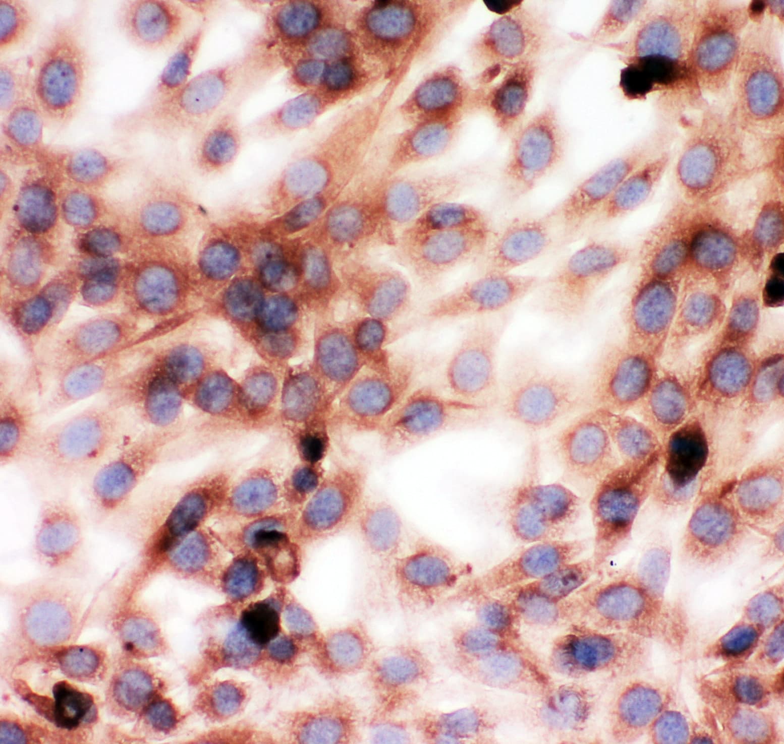 GSN / Gelsolin Antibody (aa763-775)