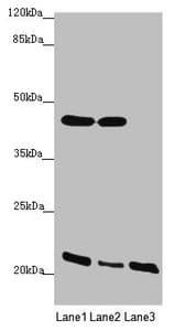 Polyclonal Rabbit anti-Human ZDHHC16 Antibody (IHC, WB)