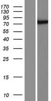 HAUS5 Protein (Over-Expression Lysate Myc-DDK (Flag))