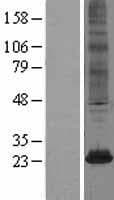 Human TSC501 / NAT8 Protein (Over-Expression Lysate Myc-DDK (Flag))