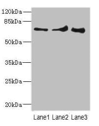 Polyclonal Rabbit anti-Human ZNF549 Antibody (IHC, WB)