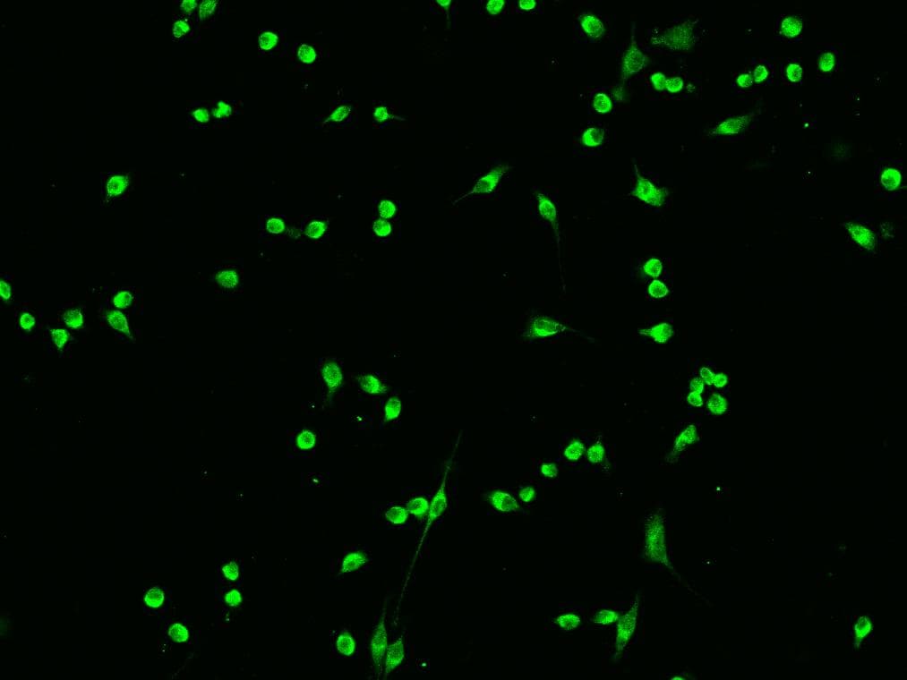 SFN / Stratifin / 14-3-3 Sigma Antibody (Preservative Free)
