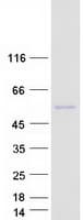 Human NIM1K / NIM1 Protein (Recombinant Myc-DDK (Flag))