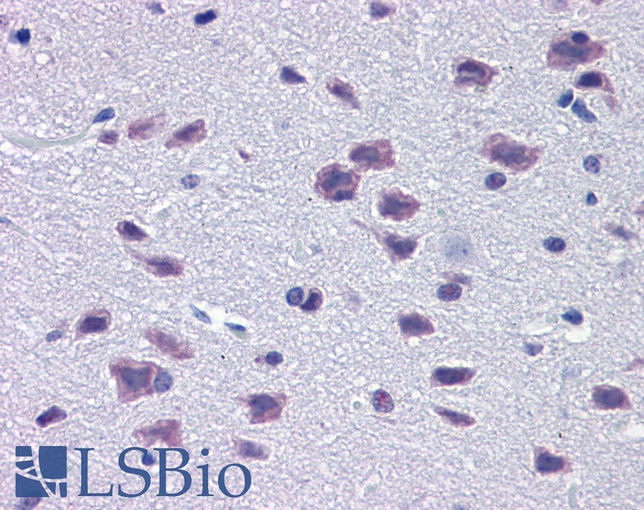 Polyclonal Rabbit anti-Mouse DMBX1 / OTX3 Antibody (aa176-225, IHC, WB)