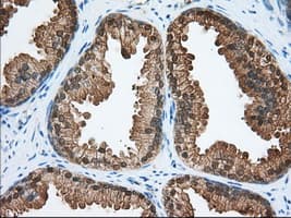 ACAT2 Antibody (clone OTI3C9)