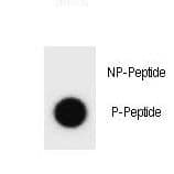 Hamartin / TSC1 Antibody (phospho-Ser561)