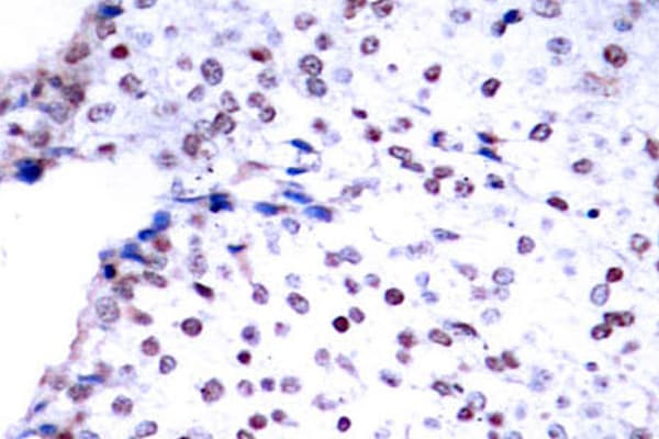 Polyclonal Rabbit anti-Human STAT3 Antibody (Pro699, IHC, WB)