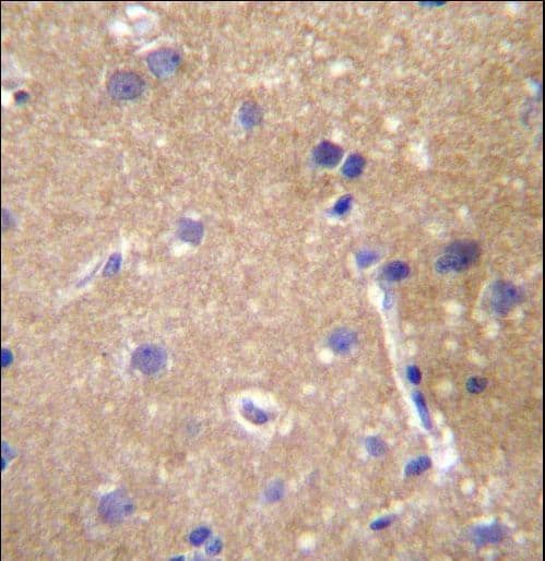 ABCC12 / MRP9 Antibody (aa723-752)