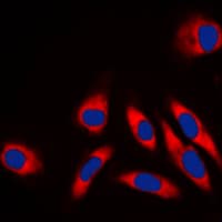 PathPlus™ HSPD1 / HSP60 Antibody (C-Terminus)