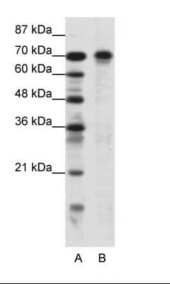 HIC1 Antibody (aa209-258)