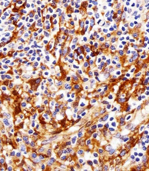 SYN / FYN Antibody (clone 1302CT390.118.237)