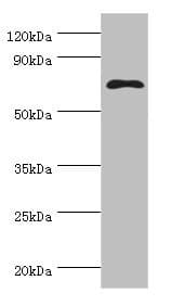 MSLN / Mesothelin Antibody (aa37-296)