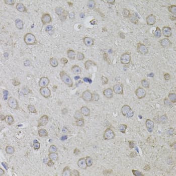 CD59 Antibody