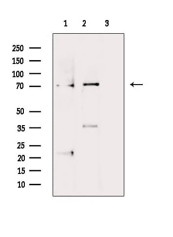 LIMK1 / LIMK Antibody (phospho-Thr508)