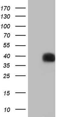 PAGE1 Antibody (clone OTI4A6)