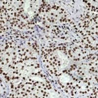 HIST1H3H Antibody