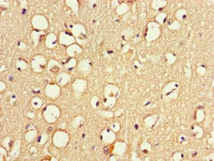ZNF365 Antibody