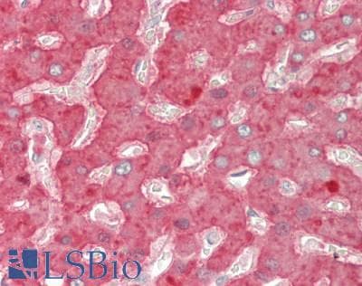 IHC-plus™ SERPINF2 / Alpha-2-Antiplasmin Antibody