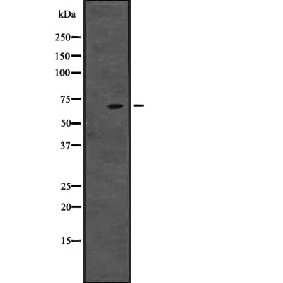 Polyclonal Rabbit anti-Human CENPT Antibody (IHC, WB)