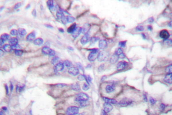 GAD65 Antibody (Asp572)