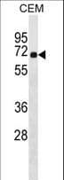 Translokin / CEP57 Antibody (aa89-117)
