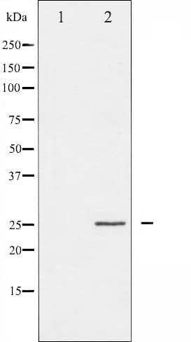 Polyclonal Rabbit anti-Human EIF4E Antibody (IHC, IF, WB)