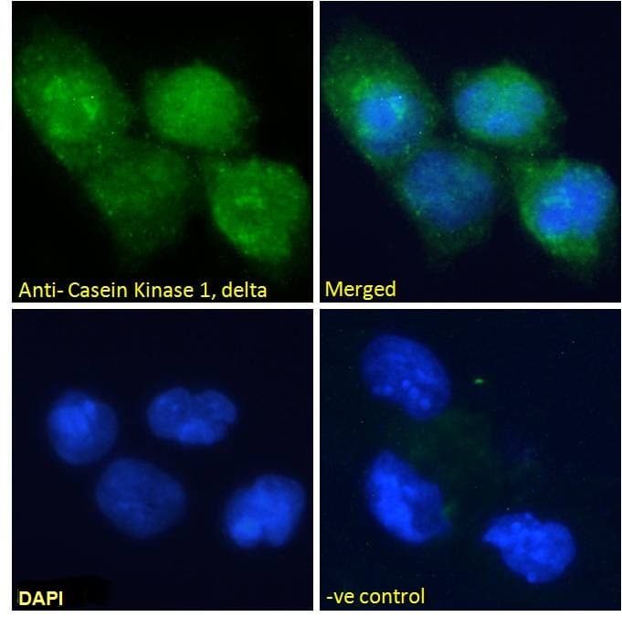 CSNK1D Antibody (aa310-324)