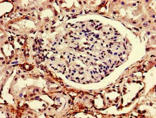 TMEM7 / RTP3 Antibody