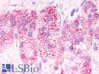 PathPlus™ Polyclonal Rabbit anti-Human GPR182 / ADMR Antibody (Cytoplasmic Domain, IHC)