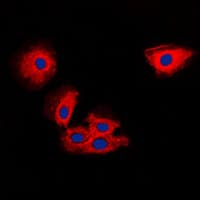 TIMP2 Antibody (Internal)