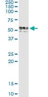 GIF / Intrinsic Factor Antibody (clone 1D9)