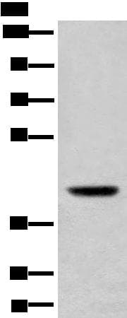 USP12 Antibody