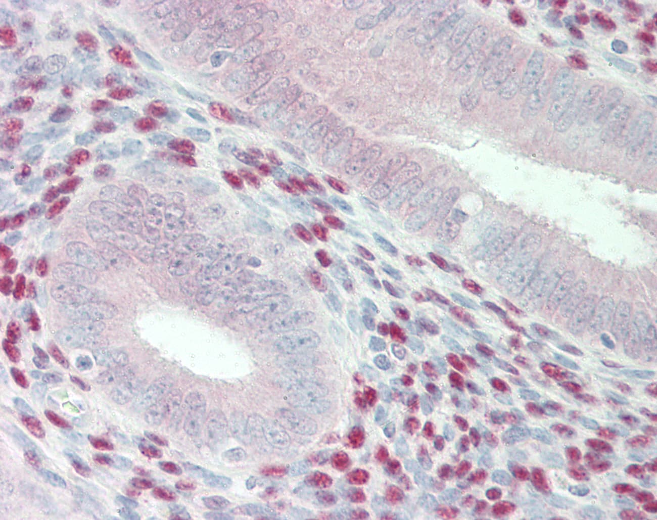 PathPlus™ Polyclonal Rabbit anti-Human APOBEC3B Antibody (IHC, IF, WB)
