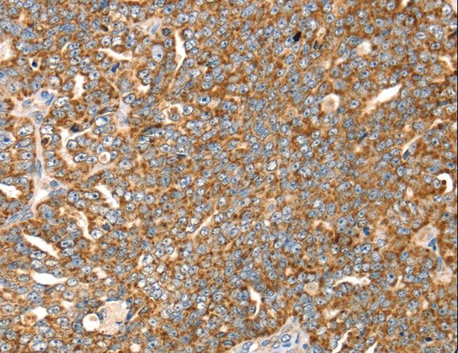 IHC-plus™ SLC8A3 / NCX3 Antibody