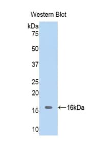 Hemoglobin Antibody