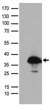 SMUG1 Antibody