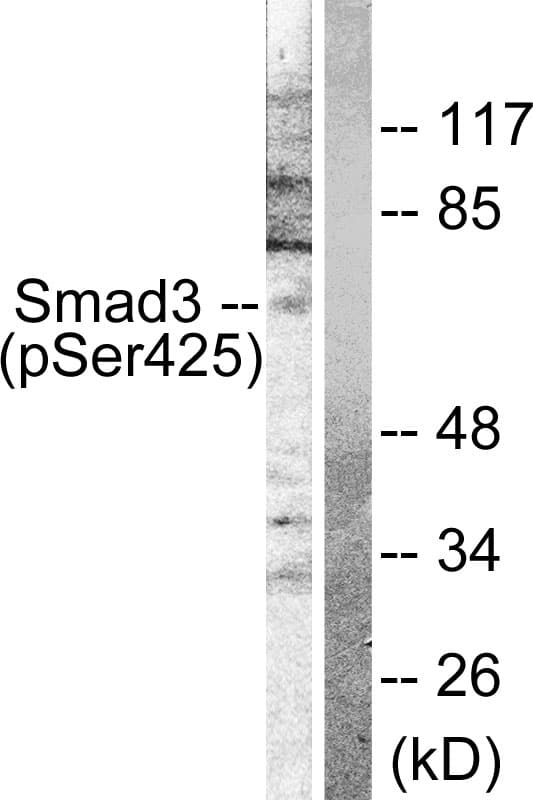 SMAD3 Antibody (phospho-Ser425)
